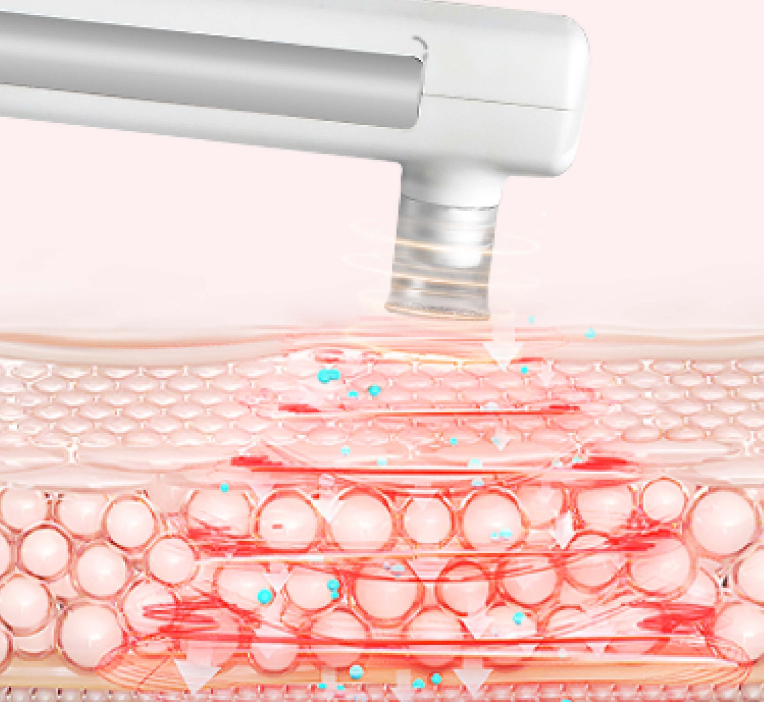 Microdermabrasion machine for facial exfoliation, designed to remove dead skin cells and promote smooth, radiant skin