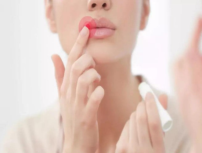 5 Steps to Lip Repair - Autumn and Winter