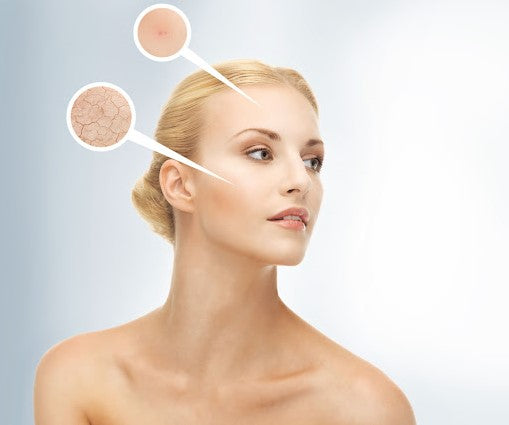 3 Ways: How to Deal with Skin Anxiety?