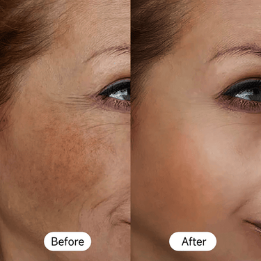 Red light therapy for face, using LED technology to reduce wrinkles, improve skin tone, and stimulate collagen production