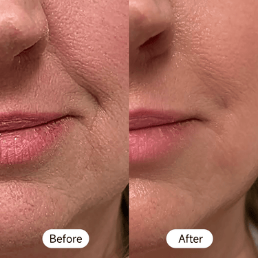 Red light therapy for face, using LED technology to reduce wrinkles, improve skin tone, and stimulate collagen production