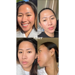 K9 Led light Therapy Mask - kingdo