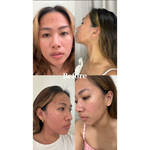 K9 Led light Therapy Mask - kingdo